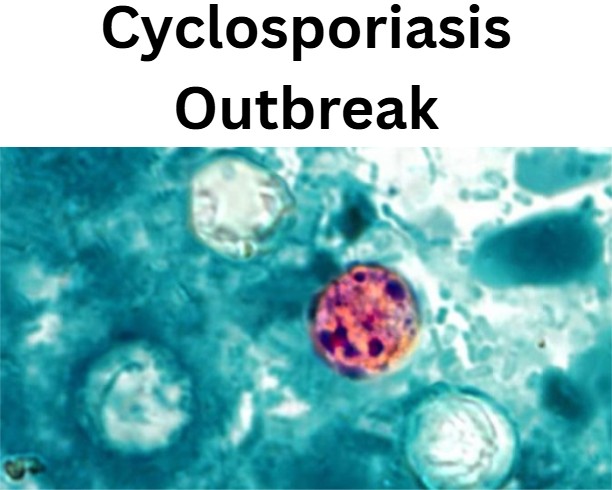 Cyclosporiasis
